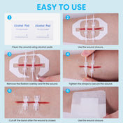Antaly Emergency Wound Closure Strips Kit – No-Stitch Butterfly Bandages for Fast, Scar-Free Healing | 1 Strip 4-Pack