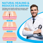 Antaly Emergency Wound Closure Strips – Waterproof Butterfly Laceration Repair Kit, No-Stitch Bandages, 3 Strips